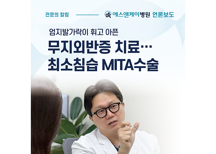 [중도일보] 엄지발가락이 휘고 아픈 무지외반증 치료…최소침습 MITA수술로